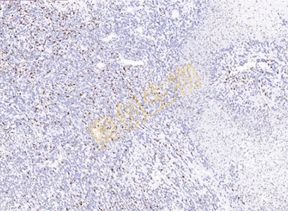 免疫组化（IHC）